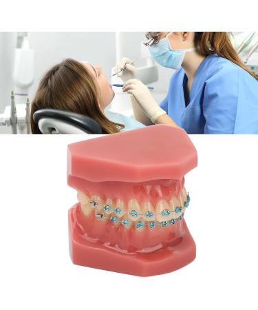Typodont Orthodontic Tooth Model (28 Teeth) - Realistic Crowded Teeth & Malocclusion Representation for Dental Education & Practice - Buy Online on GoSupps.com