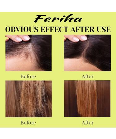 Hair Growth Advanced - Unisex Biotin & Rosemary Oil Formula for Thicker Fuller Hair | Combat Hair Loss & Damage Internationally Shipped - Buy Online on GoSupps.com