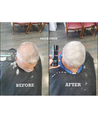 THICK FIBER Hair Building Fibres (Pack of 1 WHITE) Hair Fibres for Thinning Hair | Hair Powder for Thinning Hair 25g Bottle | Make Hair Look Thicker in Seconds with hair filler | for Women & Men 25 g (Pack of 1) White - Buy Online on GoSupps.com