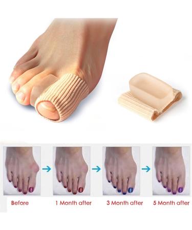 Silicone Toe Protector for Hallux Valgus & Bunion Care - Buy Online on GoSupps.com