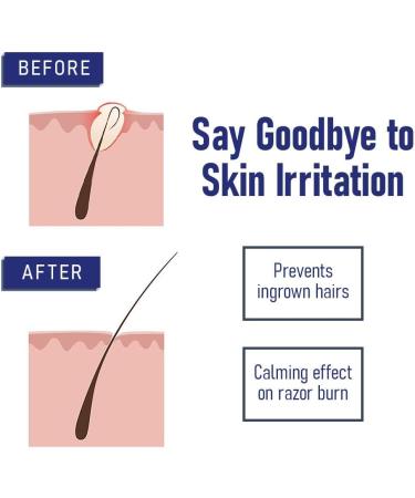 Bump Eraser After Shave Ingrown Hair Treatment for Razor Bumps Removes and Prevents Razor Burns Mens Organic Skincare - Buy Online on GoSupps.com