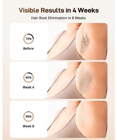 AMOTAOS IPL Laser Hair Removal Device - At-Home Ice-Cooling Safe Epilator for Women & Men | Effective Hair Removal for Face Armpits Arms Bikini Line Legs Whole Body - White-Gold - Buy Online on GoSupps.com