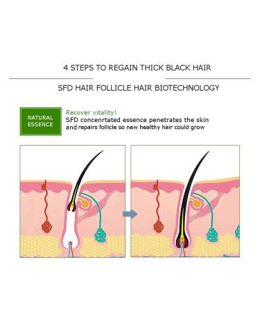 DISAAR BEAUTY Hair Growth Essential Oil 30g - Natural Plant Dry Growth Essence for Anti Hair Loss and Scalp Treatments with Genseng for Dense Hair - Buy Online on GoSupps.com