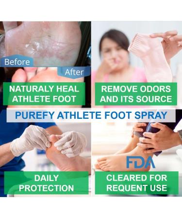 PUREFY Athlete Foot Spray 4oz 2pk - Natural Healing, Odor Removal, No Residue | Purefypro Dermal Technology | Safe for All - Buy Online on GoSupps.com