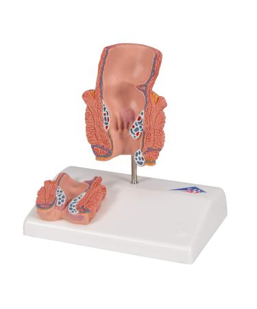 3B Scientific K27 Hemorrhoid Model with Smart Anatomy | Educational Tool - Buy Online on GoSupps.com