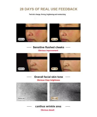 Buy Silicone Color Mask Beauty Device - International Shipping | Enhance Your Skincare Routine - Buy Online on GoSupps.com