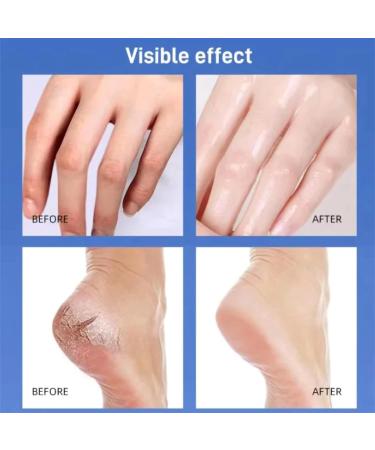 Peach Radiance Moisturizing Cream Moisturizing Cream Peach Moisturizing Cream Foot Moisturizing Cream Brightening Cream Balm For Women Foot Hand Cream - Buy Online on GoSupps.com