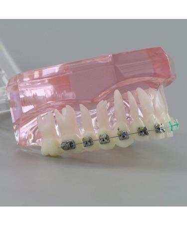 HDGRNCC Dental Orthodontic Brackets Model - Metal Ceramic Self-Ceramic Bracket for Training | International Shipping - Buy Online on GoSupps.com
