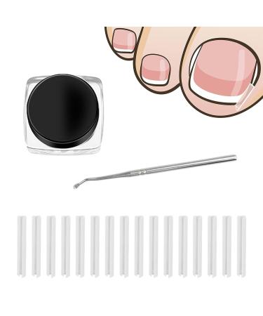 50pcs Ingrown Toenail Treatment and Corrector Kit Ingrown Toenail Correction Strips Ingrown Toenail Correction Patches Recover Clips Kit with Nail Clippers for Ingrown Toenails Foot Care Treatment