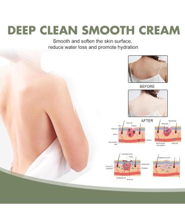 Keratosis Treatment Cream for Smooth & Deep Clean Skin - 3pc Set - Buy Online on GoSupps.com