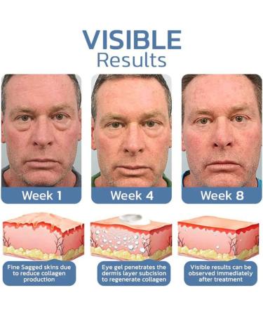 OPENEYES Awaken Peptide Lifting Eye Gel OPENEYES Peptide Eye Gel openeyes Lifting Eye Gel Peptide Depuffing Eye Gel Men Eye Cream Anti Aging Lifts Firming Anti-Wrinkle Eye Tightener (2PCS) - Buy Online on GoSupps.com