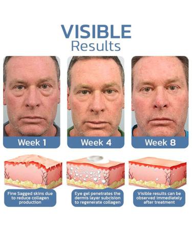 Openeyes Rejuvenating Eye Lifting Gel for Men & Women | Peptide-Tight & Depuffing Eye Gel | Anti-Aging Solution (2PCs) - Buy Online on GoSupps.com