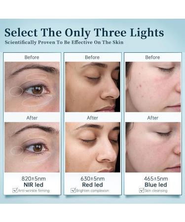 GYH Led Face Mask Light Therapy  Red Light Therapy for Face  FSA/HSA Eligible  Wireless High Dose Red  Infrared & Blue Light Therapy Mask for Skin Care  Anti-ageing Cloud-S (RB-014) - Buy Online on GoSupps.com