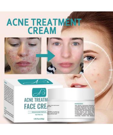 Acne B-Gone Moisturizer Cream - Tea Tree Oil Nighttime Treatment for All Skin Types Fights Pimples Overnight - Buy Online on GoSupps.com