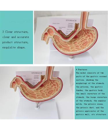 Educational Model Simulated Human Stomach Anatomy Model Diseased Stomach Model Stomach Disease Demonstration Model Pathological Stomach Model Medical Models - Buy Online on GoSupps.com