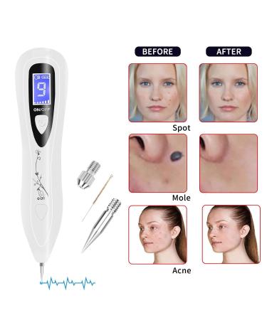 CHRERNA Plasma Pen Device for Hand & Body - Remove Warts Moles Pigment Spots Age Spots | Fast International Shipping - Buy Online on GoSupps.com