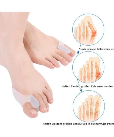 Toe Spreader 6-Piece Set | Large Hallux Valgus Correction & Silicone Separator for Women & Men | Effective Gel Protection for Foot Stretching - Buy Online on GoSupps.com