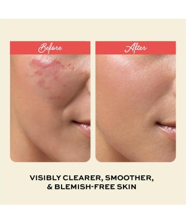 Buy Clarifying Toner with Salicylic Acid - Oil Control & Spot Treatment | Cruelty-Free Skincare | 7.04 oz by The Natural and Organic Family - International Shipping Available - Buy Online on GoSupps.com