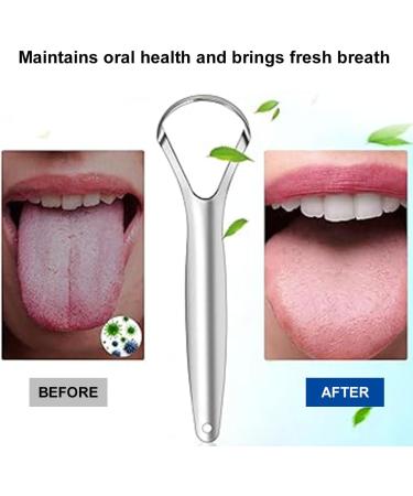 Stainless Steel Tongue Cleaner & Scraper | Eliminate Bad Breath & Promote Oral Hygiene - Buy Online on GoSupps.com