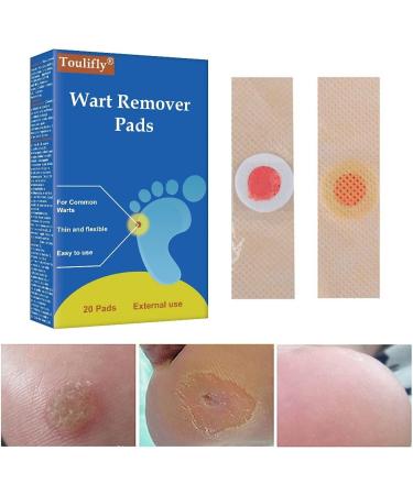 Wart Remover Pads - Treatment for Hands and Feet, Callus Removal, Verruca Relief, Pain Removal - 20 Count Pack - Buy Online on GoSupps.com