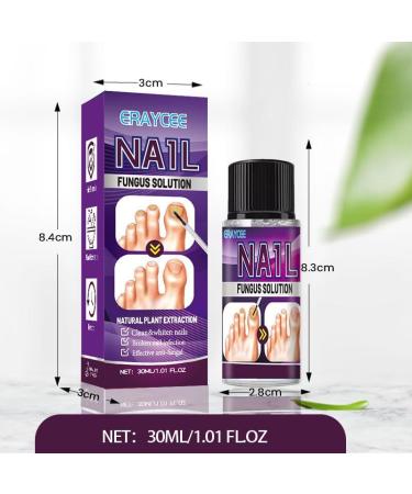 Fungal Nail Treatment Plant Essence Treatment Solution 30ML Special Nail Care Solution Athlete's Foot Toenails Broken Nails And Discolored Nails Restore Healthy Nails - Buy Online on GoSupps.com