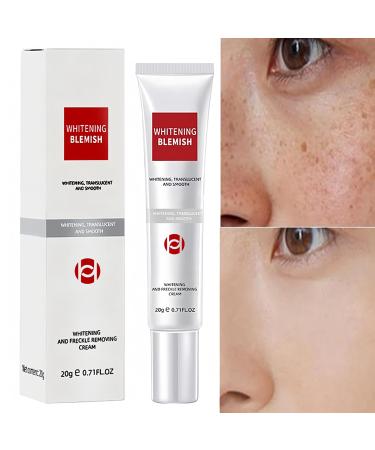 Q.Z.Art Dark Spot Corrector Cream Dark Spot and Other Remover for Face Suitable for All Skin Types - Melasma Freckle Sun Spot Removal Blemish Reducer