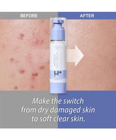 OOTD Intensive H+ Face Serum A.M 50g - Hyaluronic Acid + Vitamin C Formula - Daytime Moisturizing Facial Cream | 1.69 Fl Oz - Buy Online on GoSupps.com