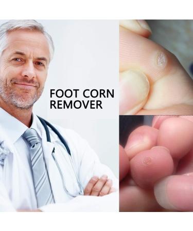 Zhangl Massage 20 Boxes Foot Corn Remover Feet Care Massage