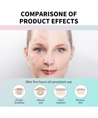 LINXINS 208 Dots Acne Starface Pimple Patch 6 Color Star Face Pimple Patches Stars - Star Spot Patches - Pimple Patches Cute - star Patches for Spots for Acne Blemish Pimples Whiteheads Zit - Buy Online on GoSupps.com