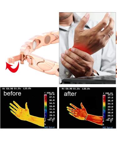 Men's Rose Gold Magnetic Field Therapy Bracelet - Adjustable 7.8 Magnetic Hard Band - Ideal Health Gift - Buy Online on GoSupps.com