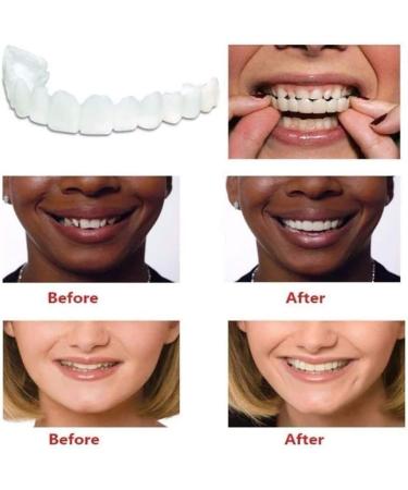 Buy Congming-Huajia Cosmetic Prostheses - Upper & Lower Teeth Replacement for Men & Women | 2 Pairs Provisional Prosthetics | International Shipping Available - Buy Online on GoSupps.com