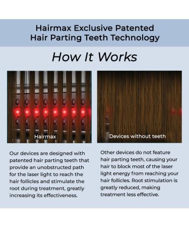 Hairmax ULTIMA 12 Classic Laser Comb for Hair Growth | FDA Cleared Treatment for Men & Women | Thinning Hair Solution for Denser, Fuller Hair | Spot or Full Scalp Growth Products - Buy Online on GoSupps.com