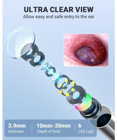 Anykit Digital Otoscope with Gyroscope, 4 Inches Screen, 3.9mm Ear Scope Camera with 6 Lights, Ear Wax Removal Tool, 32GB Card, Supports Photo Snap and Video Recording - Buy Online on GoSupps.com