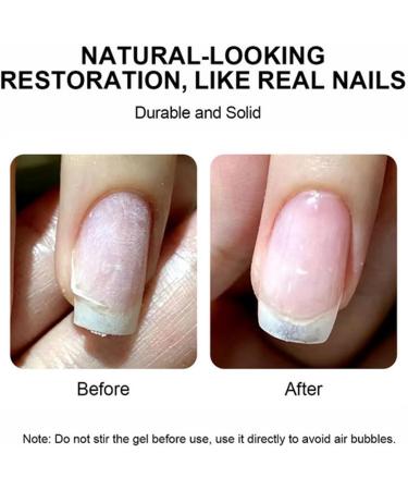  G n rique Broken Nail Repair Kit 5g Glue Gel Tweezers Nail Repair Gels Temporary Manicure Repair Protector | Accessories for Women and Girls Manicure Care - Buy Online on GoSupps.com