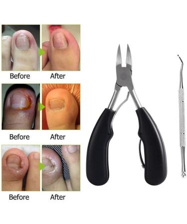 PSGS A Set Nail Clippers Ingrown Toenail Podiatry Correction Nippers Cuticle Cutters Cut Paronychia Pedicure Manicure Hand Foot Care (Color : Orange) - Buy Online on GoSupps.com