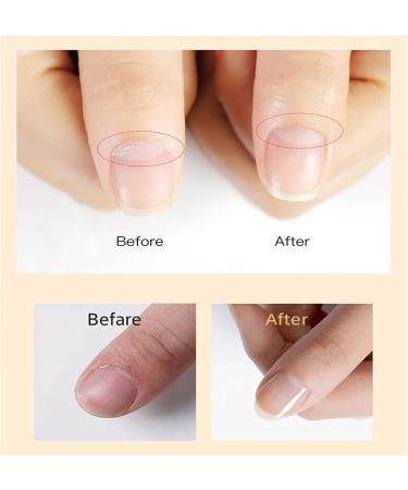 24K Gold Leaf Cuticle Oil Moisturizing Oil for Repaired Dry Damaged Cuticles Vegan Hydrating Nourishing Nail Care Nail Strengthening Oil - Buy Online on GoSupps.com