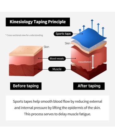STARZON Kinesiology Tape (6 Rolls) Original Cotton Elastic Premium Athletic Tape Latex Free 2 x 5.4yd Beige Pack of 6 Beige 2 x 5.4yd - Buy Online on GoSupps.com
