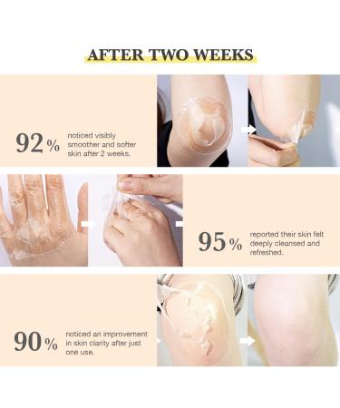 Chemical Peel for Face - Peeling Oil for Facial & Body Exfolianting with 16% Salicylic Acid - Dead Skin Remover with Gentle Formula for All Skin Type - 110mL(3.66OZ) - Buy Online on GoSupps.com