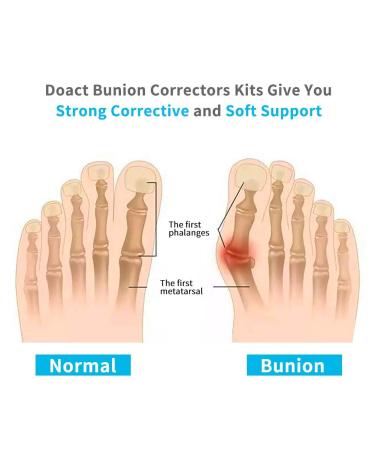 Hallux Valgus Rail & Nighttime Toe Straightener Brace - 6PC Soft Pain Relief Gel Toe Separators for Men & Women | Bunion Splint (S | 35-38.5) - International Shipping - Buy Online on GoSupps.com