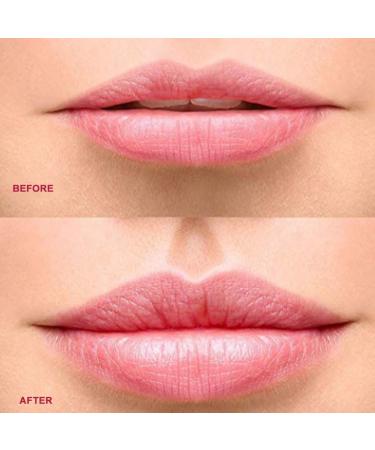 Zetail USB Automatic Lip Filler - Portable Electric Lip Amplifier with 3 Suction Forces for Full Lips | Ideal for Women - International Shipping Available - Buy Online on GoSupps.com