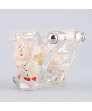 Teeth Model for Dental Teaching & Research | Realistic Adult Teeth Demonstration | No Brand - Buy Online on GoSupps.com