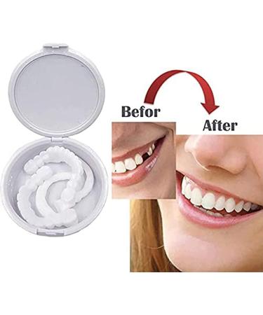 Instant Veneers & Provisional Dentures Mxrfactory Removable Snap-On Teeth for Comfort & Whiteness 6 Pairs for Men & Women - Buy Online on GoSupps.com