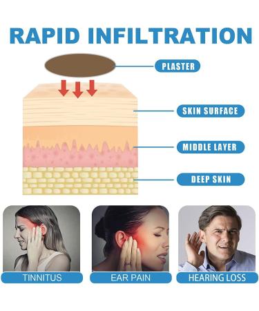 Zhongdawei Tinnitus Ear Patches - 10 Natural Plant Stickers for Hearing Protection & Health Care - Buy Online on GoSupps.com