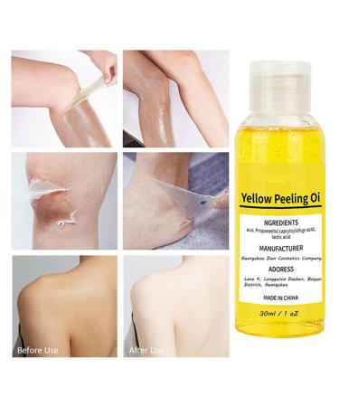 Super Strength Yellow Peeling Oil for Dark Skin - 30/50ml Exfoliating Lightening Treatment - Extra Strength for All Skin Types - Buy Online on GoSupps.com