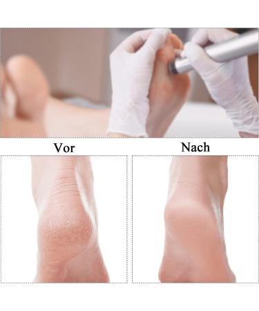 Qingmeng Feet Grinder Replacement Grinding Paper - 100PCs Sandpaper for Pedicure & Cracked Heels Care (15mm) - Buy Online on GoSupps.com