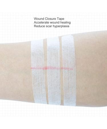 Wound Closure Bandage 10pcs- Portable Breathable Skin Closure Strap for Adult Protection - 0.2 X 3.9in - 2 Sheets - Buy Online on GoSupps.com