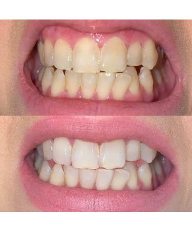 Buy CMIIL High-Quality PAP Teeth Whitening Strips - 14 Treatments Peroxide-Free Gentle on Enamel 28 Stripes for Sensitive Teeth - Buy Online on GoSupps.com