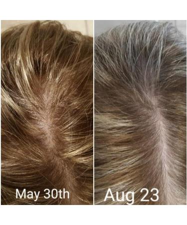 CRISAN Extreme Hair Strengthening Oil - 16 oz - 55 Organic Vegan Essential and Carrier Oils - Thicken Grow and Restore Hair for Shinier Healthier Locks - Buy Online on GoSupps.com