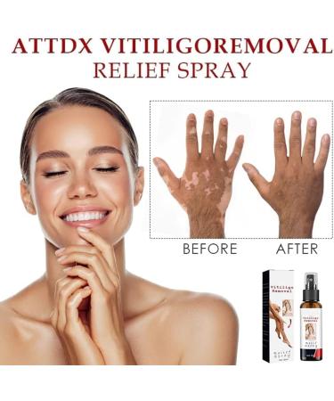DUBUSH Vitiligo Removal Relief Spray - Skin Repair for Face and Body (3pcs) - Buy Online on GoSupps.com