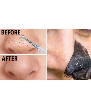 Shop Peel-Off Black Mask for Deep Cleansing | Worldwide Shipping Available - Buy Online on GoSupps.com